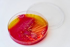 Petrischaaltje met rood gele substantie