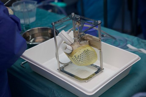 UMC successfully completes first artificial hart implant for the Netherlands