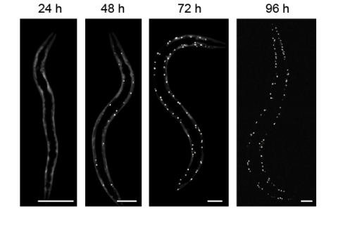 Confocal images of C. elegans expressing polyQ