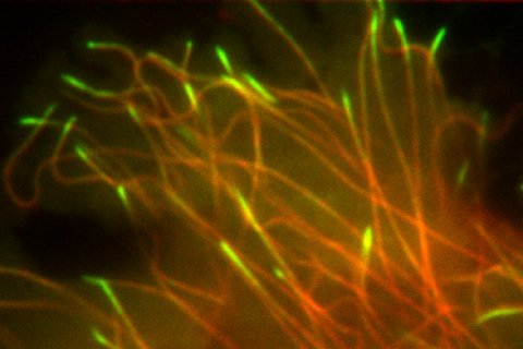 Groei en verkorting van microtubili, met fluorescerende markers op de uiteindes. Credit: cellen Ilya Grigoriev, Universiteit Utrecht, in vitro, Ankit Rai, Universiteit Utrecht.