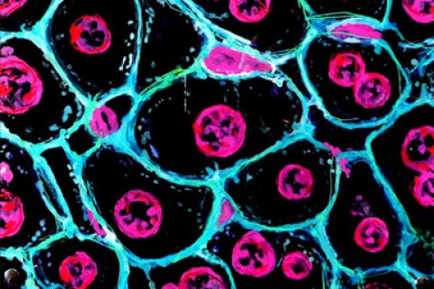 Polyploid cells in liver tissue