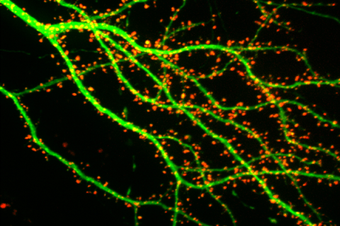 Fluorescentie-afbeelding van dendrieten (groen) van een zenuwcel met synapsen (rood).