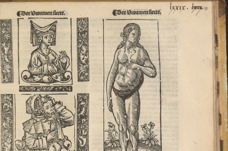 Blad met lezerssporen uit Petrus Sylvius, Tfundament der medicinen ende chyrurgien (Antwerpen: Willem Vorsterman, 1540), fol. P4r. Washington D.C., Library of Congress, Rosenwald 1159.